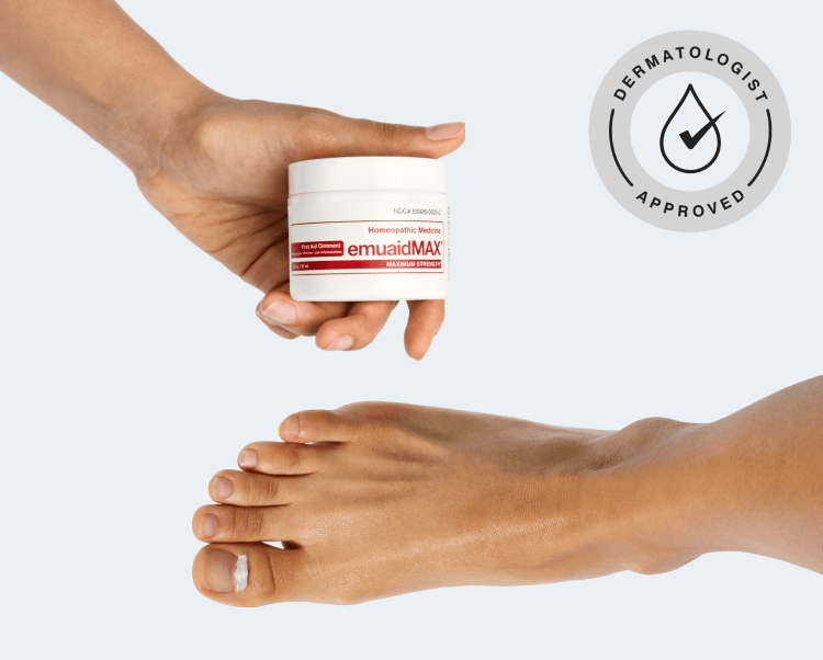 Anti-fungal cream infections hand foot itching treatment itchy relief  ointmen | eBay